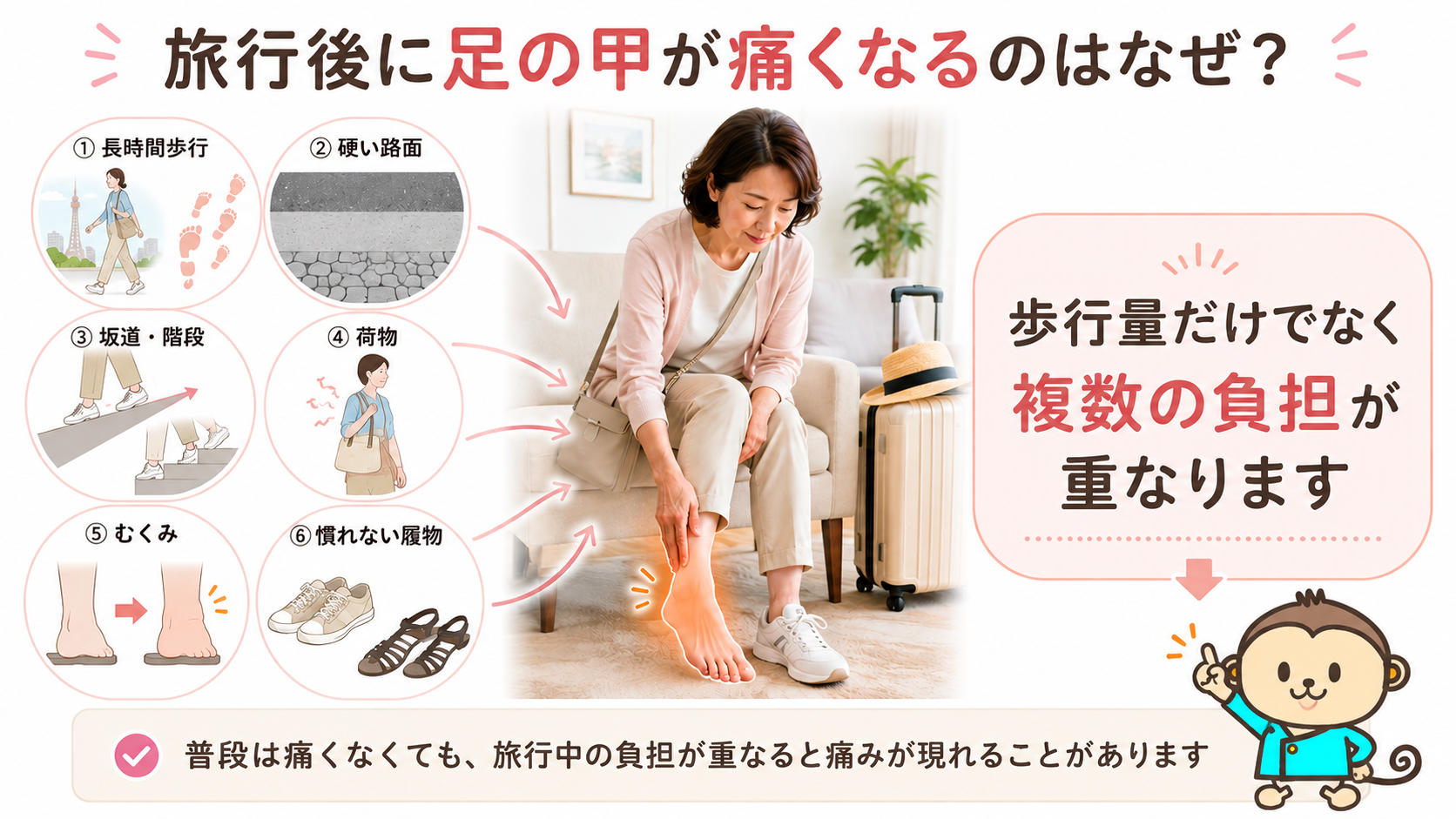 旅行後に足の甲を気にする女性と、長時間歩行・硬い路面・坂道・荷物・むくみ・慣れない履物による負担を示した図