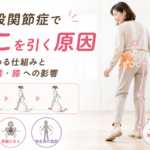 変形性股関節症でびっこを引く原因｜歩き方と体への影響