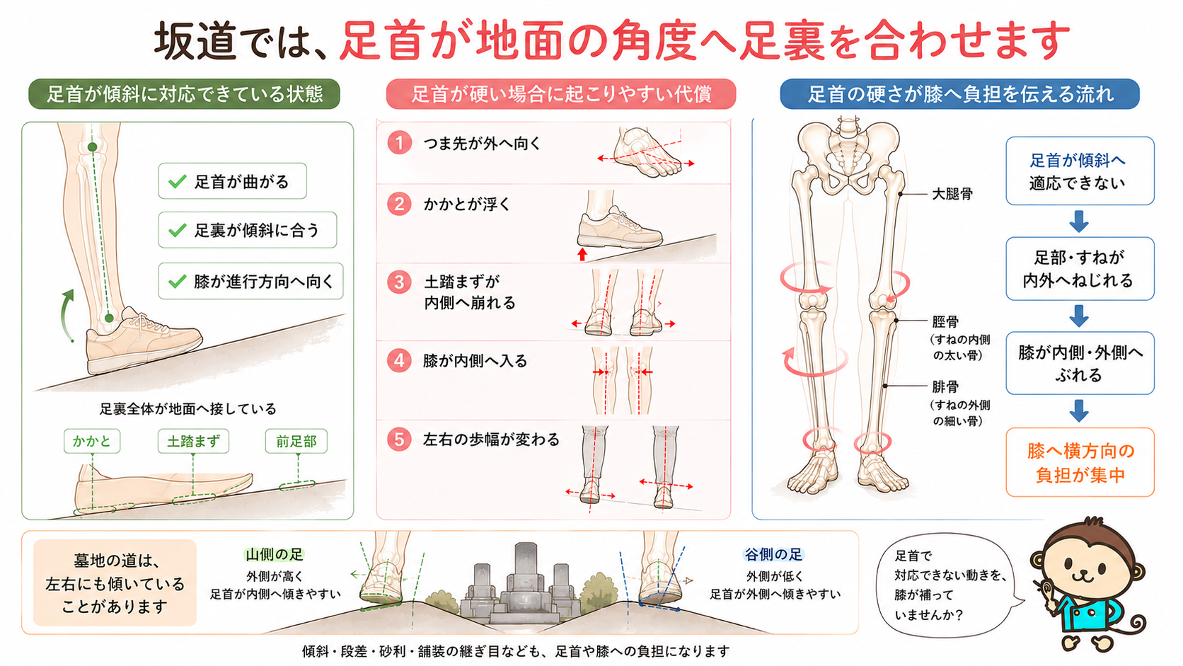足首が坂道の傾斜へ適応する状態と、足首の硬さによるつま先の外向き、かかとの浮き、膝の内側への崩れを示した医療図解