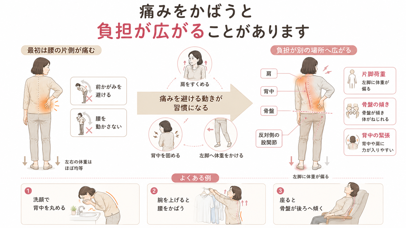右腰の痛みをかばって左脚へ体重をかけることで、骨盤が傾き、肩や背中、反対側の股関節へ負担が広がる様子