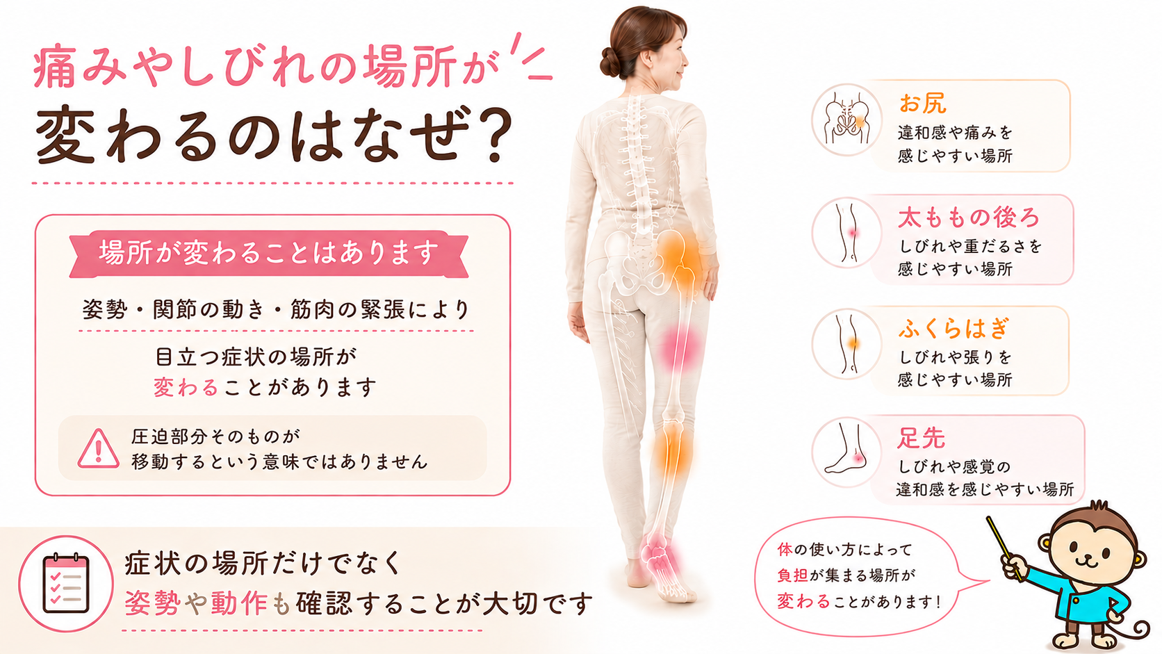 脊柱管狭窄症でお尻、太ももの後ろ、ふくらはぎ、足先の痛みやしびれの場所が変わる理由を示す人体図
