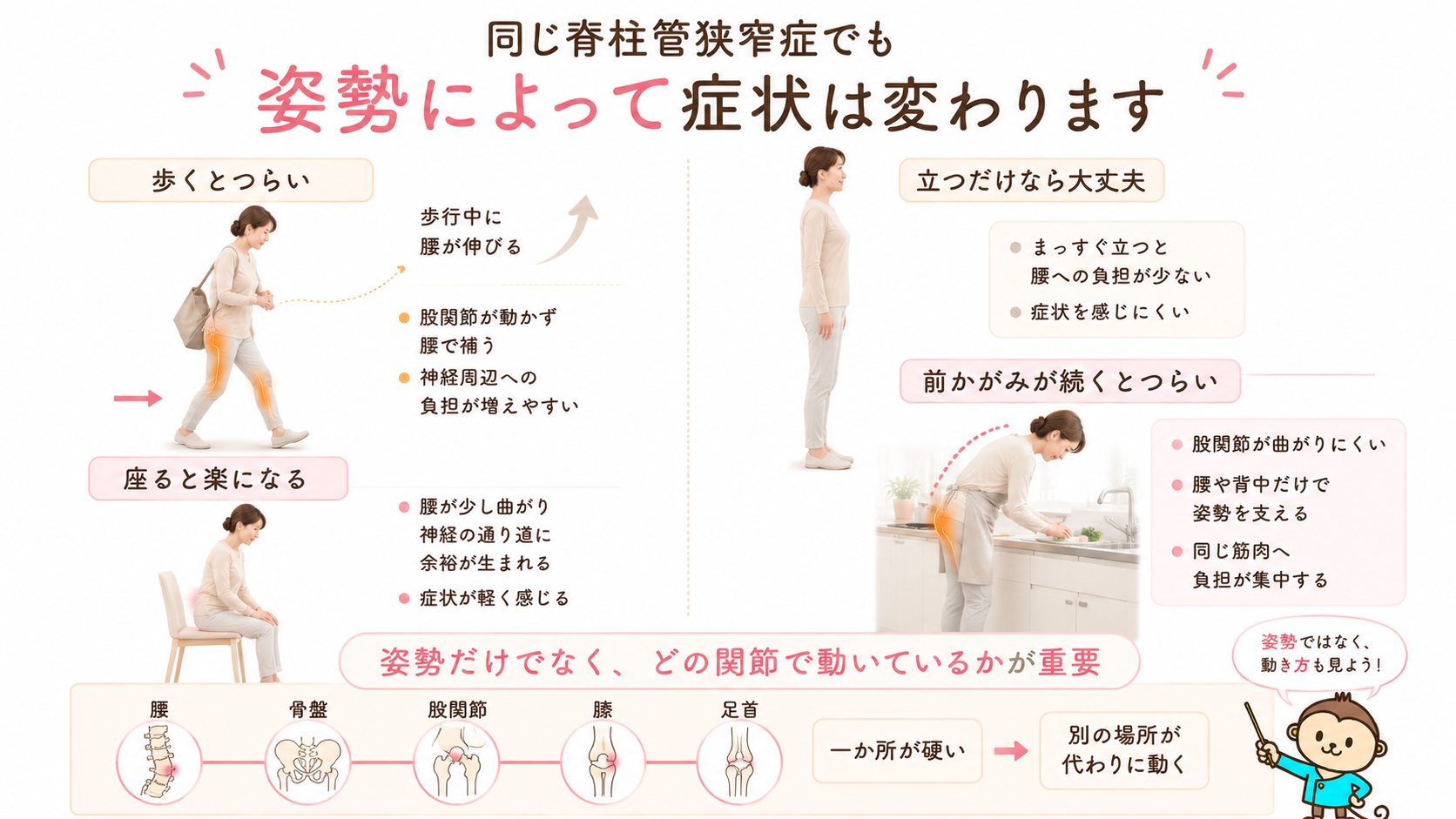 歩くとつらく座ると楽になる場合と、前かがみで腰や足がつらくなる場合を比較した脊柱管狭窄症の図解