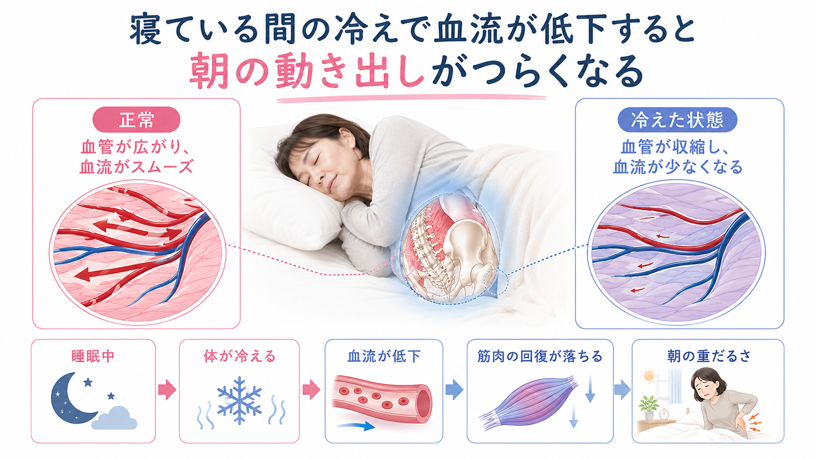 寝ている間の冷えで血管が収縮し、腰まわりの血流低下から朝の重だるさにつながる流れを示した画像