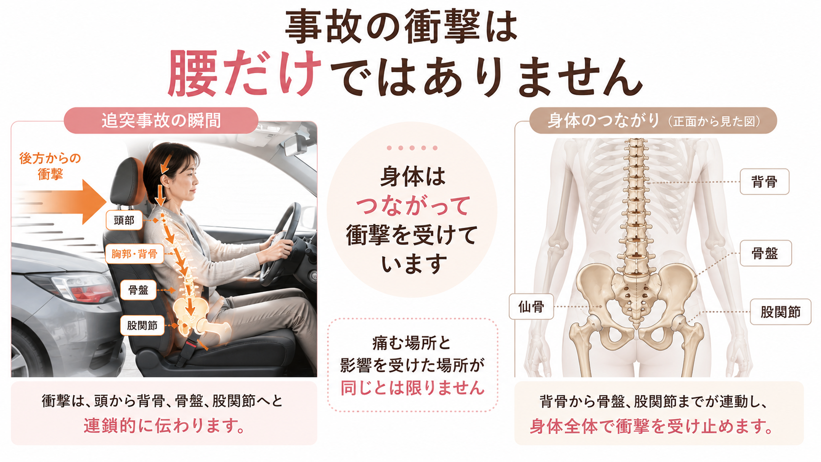 追突事故の衝撃が腰だけでなく背骨・骨盤・仙骨・股関節へ伝わる身体のつながりを示した図
