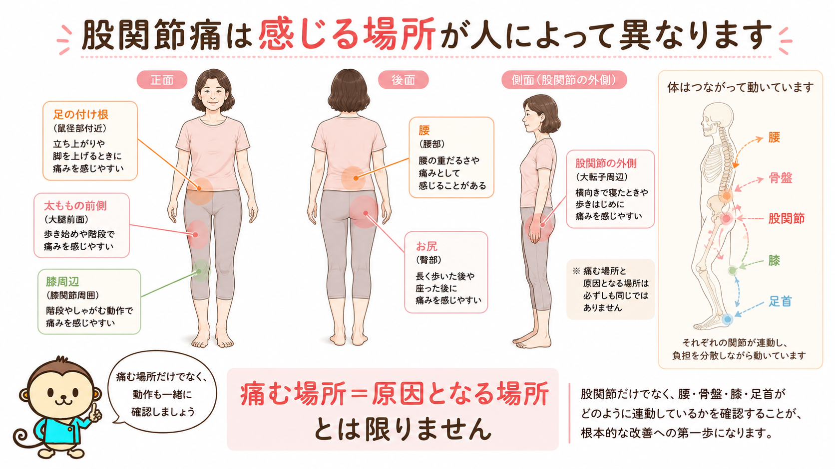 股関節痛を感じやすい足の付け根、太もも、膝、腰、お尻、股関節外側の位置と、腰から足首までの連動を示した人体図