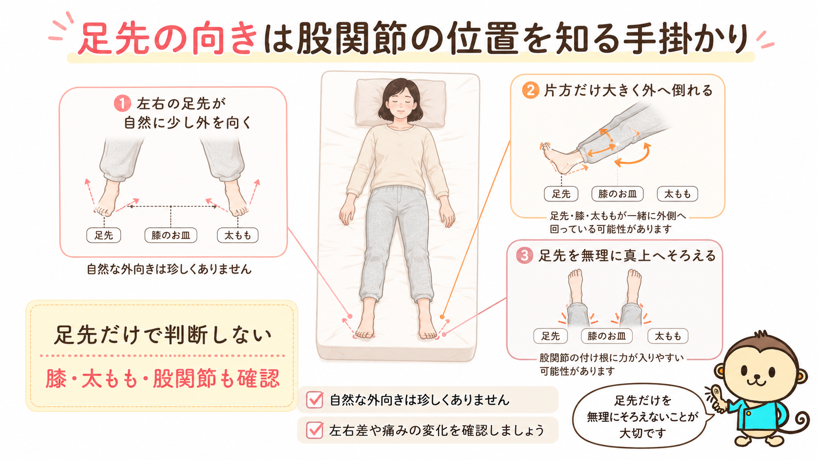 仰向けで寝た女性の足先、膝、太ももの向きを比較し、自然な外向きや片脚だけ外へ倒れる状態を示した股関節の解説図