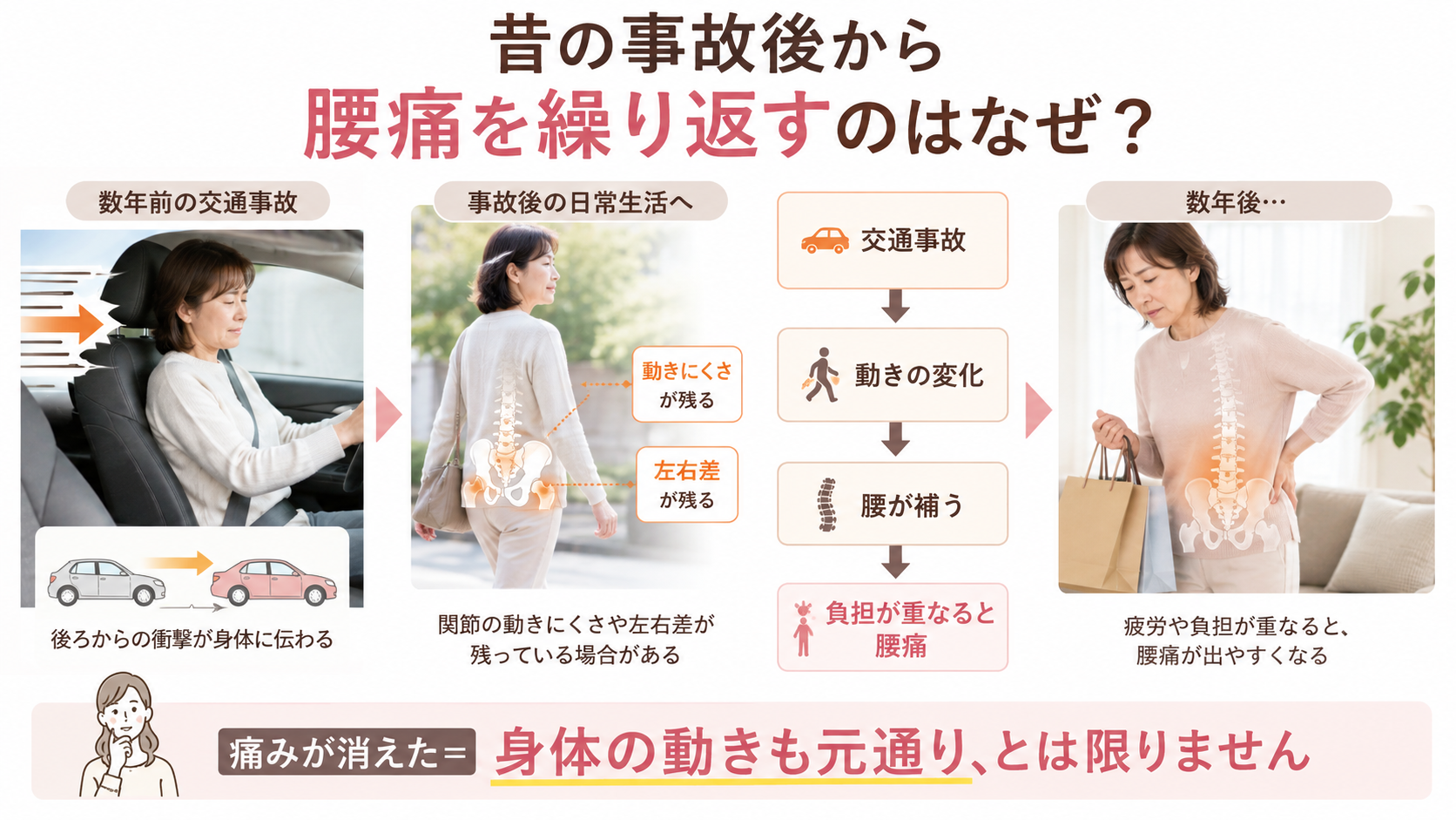 昔の交通事故後に身体の動きや関節の左右差が残り、腰が動きを補うことで負担が重なり腰痛を繰り返す流れを示した図