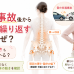 昔の交通事故後に腰痛を繰り返す原因は？関節の硬さとの関係
