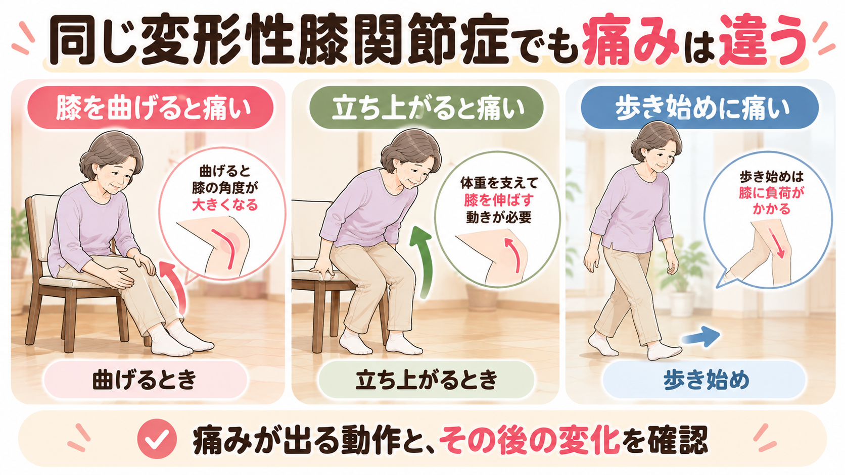 変形性膝関節症で膝を曲げるとき、椅子から立ち上がるとき、歩き始めに痛みが出る3つの場面を比較したイラスト