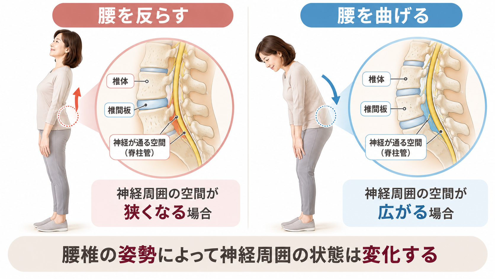 腰を反らす姿勢と曲げる姿勢を比較し、腰椎の動きによって神経が通る空間の広さが変化する様子を示したイラスト