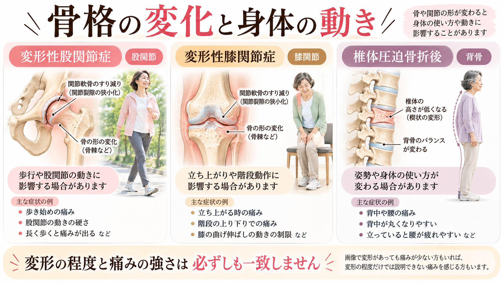 変形性股関節症・変形性膝関節症・椎体圧迫骨折後の骨格の変化と、歩行や立ち上がり、姿勢への影響を比較したイラスト