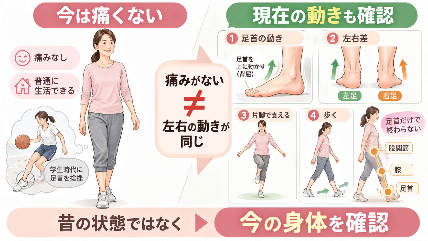 昔の足首捻挫で現在痛みがなくても、足首の動きや左右差、片脚立ち、歩き方を確認する考え方